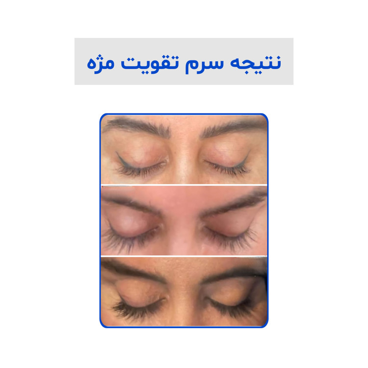 رضایت مشتریان و تجربه استفاده از سرم مژه لاکچری کوین