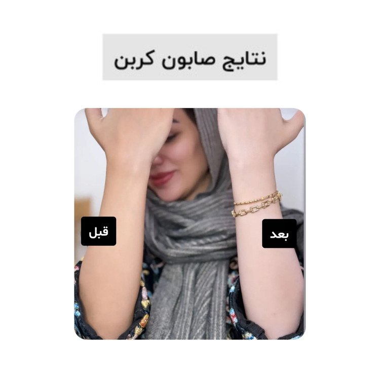 صابون بیوممتیک کربن اکتیو بیز ضد جوش ضد لک روشن کننده